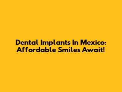 Dental Implants In Mexico: Affordable Smiles Await!